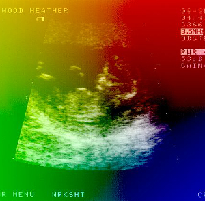 Ultrasound Scan